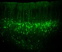 Neue Erkenntnisse zu neuronalen Aktivitäten im sensomotorischen Kortex